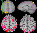 brain scans