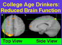 brain slide 3 small